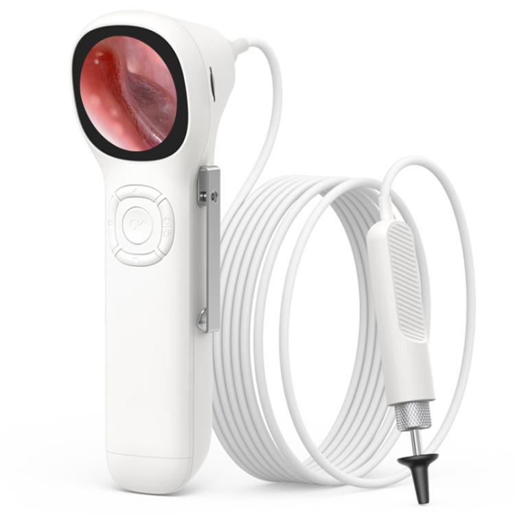 TESLONG SA160 1.45 Inch HD Screen Handheld Smart Visual Otoscope, SA160