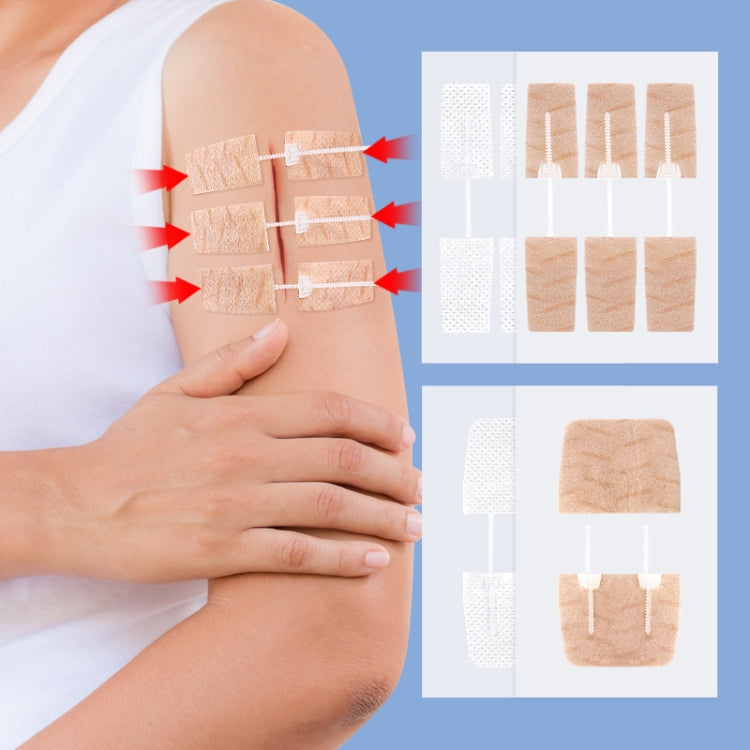 Non-woven Elastic Tape Bandage Patch Two Way Zipper Skin Latch Pull Tight Self-Adhesive Bandage Patch, White 2 Buckles, Skin Color 2 Buckles, White 3 Buckles, Skin Color 3 Buckles