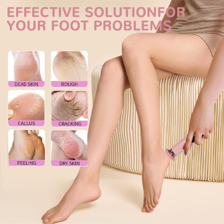 Electric Foot File with Forward/Reverse Rotation 6-Speed Exfoliator for Calluses