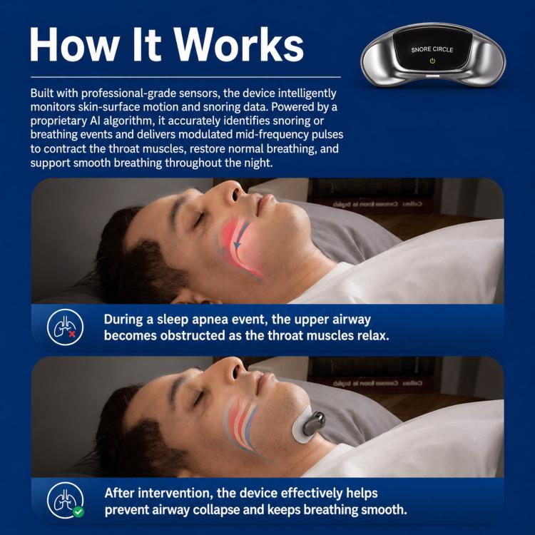 SNORE CIRCLE Smart Anti-Snoring Device Upgraded TENS & EMA Throat Snore Stopper With 3-Contact Electrode & App Tracking, YA4600